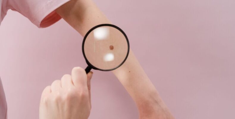 dermatološka klinika